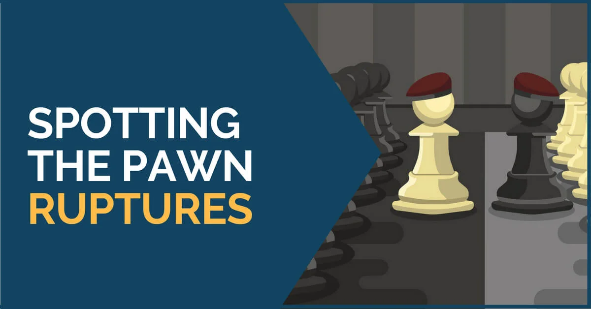 Spotting the Pawn Ruptures